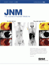 Journal of Nuclear Medicine: 51 (6)