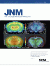 Journal of Nuclear Medicine: 51 (7)