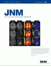 Journal of Nuclear Medicine: 52 (8)