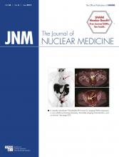 Journal of Nuclear Medicine: 56 (6)