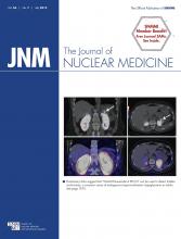 Journal of Nuclear Medicine: 56 (7)