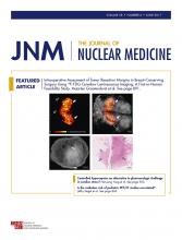 Journal of Nuclear Medicine: 58 (6)