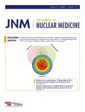 Journal of Nuclear Medicine: 60 (1)