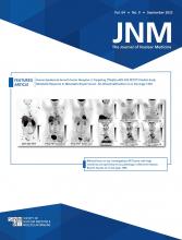 Journal of Nuclear Medicine: 64 (9)